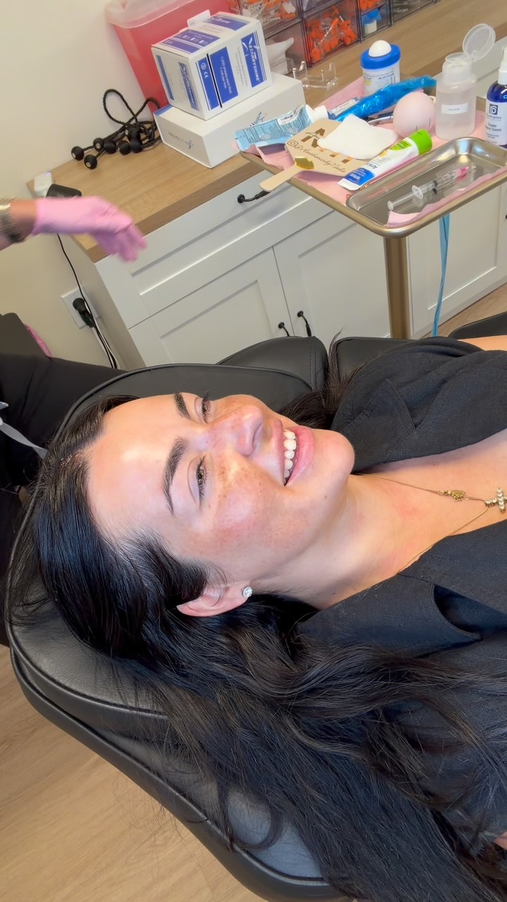 Microneedling treatment at Aesthetics by NHT